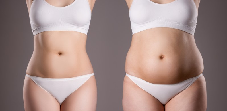 Before and after: Traditional liposuction in Denver CO